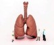 Israelische Medizin: Biogedruckte 3D-Lungen für globale Transplantationen